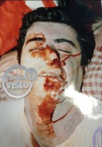 Attilio Manca. Secondo la Procura di Viterbo a distruggere il suo volto è stata la caduta accidentale sul telecomando. 